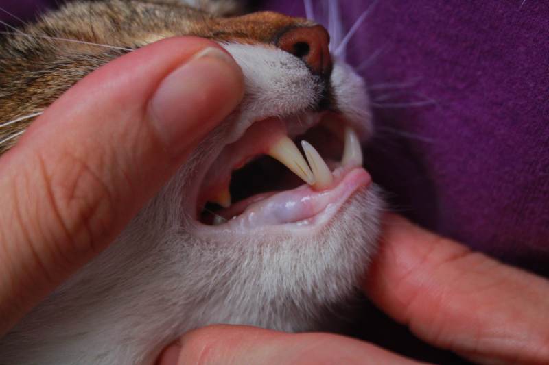 beau-teeth
